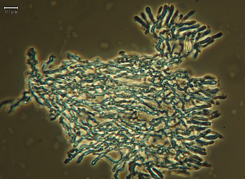 Lavoro - Crosta foto 0577 (Dacryobolus sudans)